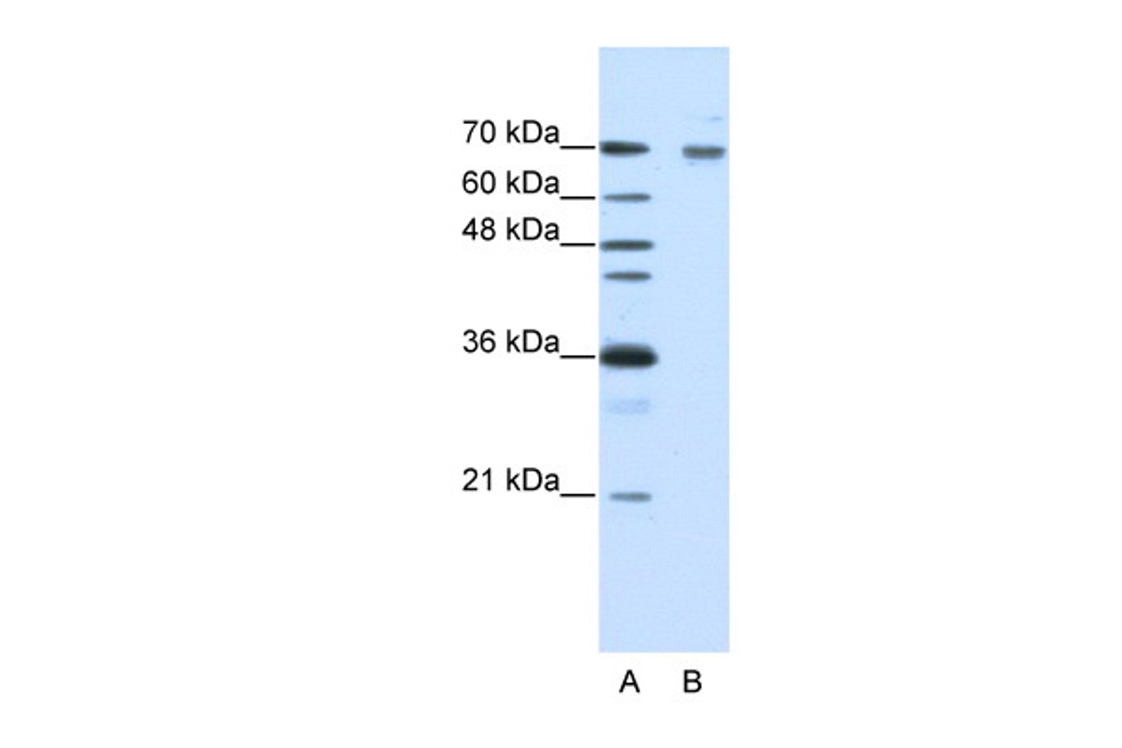 Antibody used in WB on Human HepG2 at 0.2-1 ug/ml.