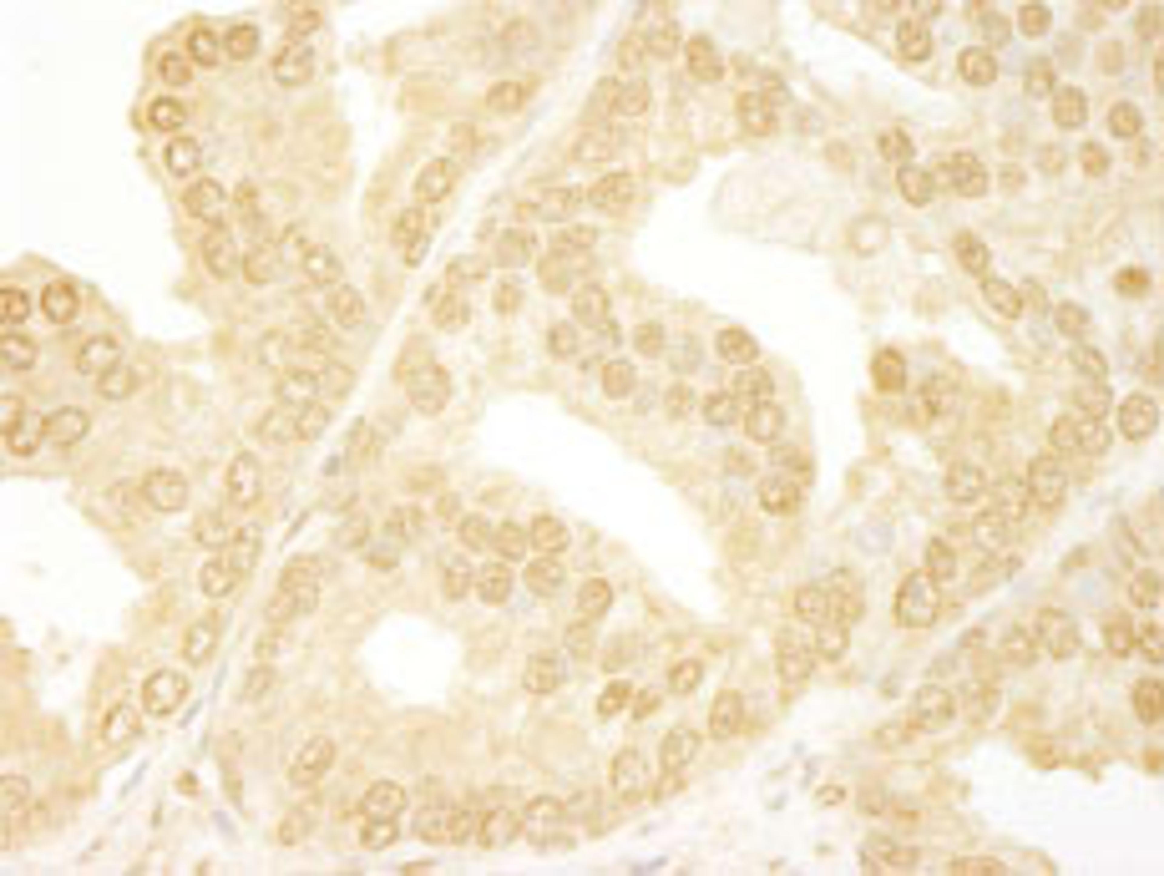 Detection of human ANKRD17 by immunohistochemistry.