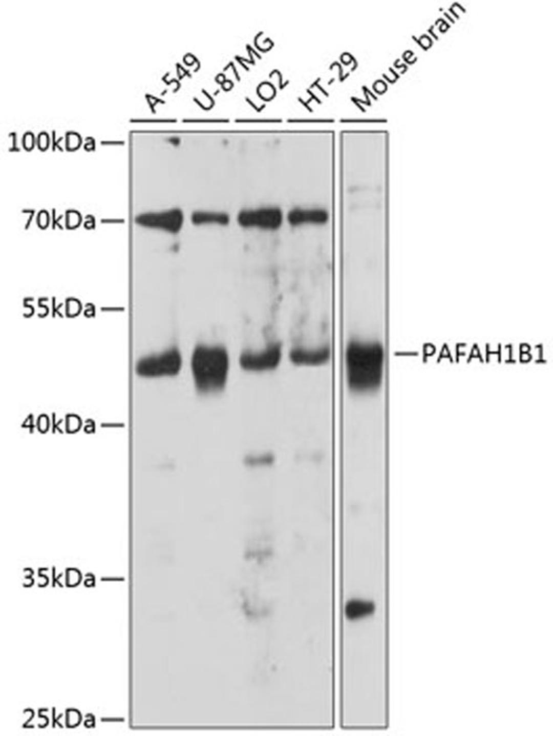 Western blot - PAFAH1B1 antibody (A12643)