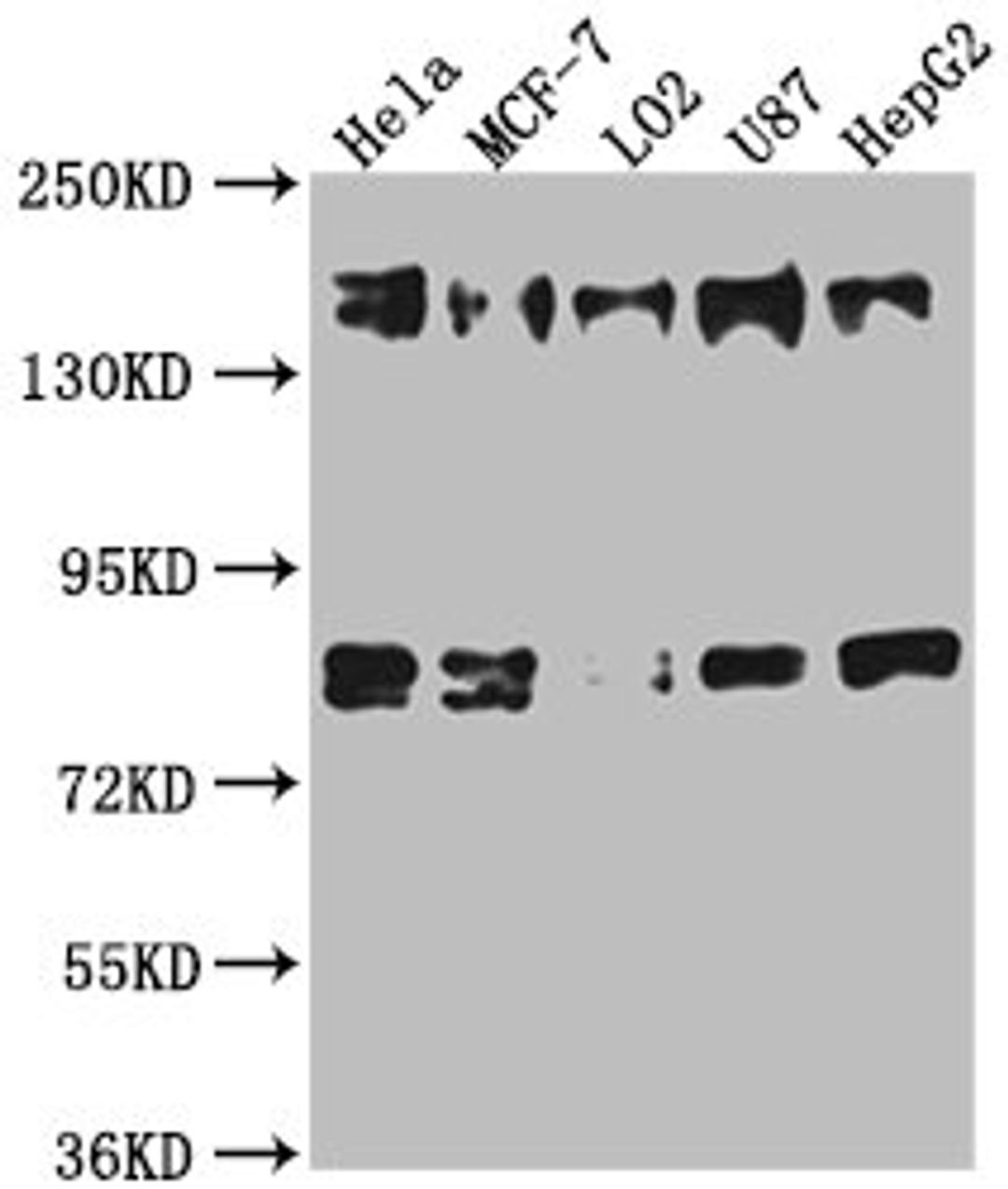 Western Blot. Positive WB detected in: Hela whole cell lysate, MCF-7 whole cell lysate, L02 whole cell lysate, U87 whole cell lysate, HepG2 whole cell lysate. All lanes: ZFYVE9 antibody at 1:1000. Secondary. Goat polyclonal to rabbit IgG at 1/50000 dilution. Predicted band size: 157, 151, 84 kDa. Observed band size: 157 kDa.