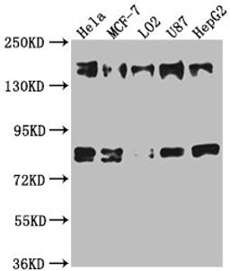 Western Blot. Positive WB detected in: Hela whole cell lysate, MCF-7 whole cell lysate, L02 whole cell lysate, U87 whole cell lysate, HepG2 whole cell lysate. All lanes: ZFYVE9 antibody at 1:1000. Secondary. Goat polyclonal to rabbit IgG at 1/50000 dilution. Predicted band size: 157, 151, 84 kDa. Observed band size: 157 kDa.
