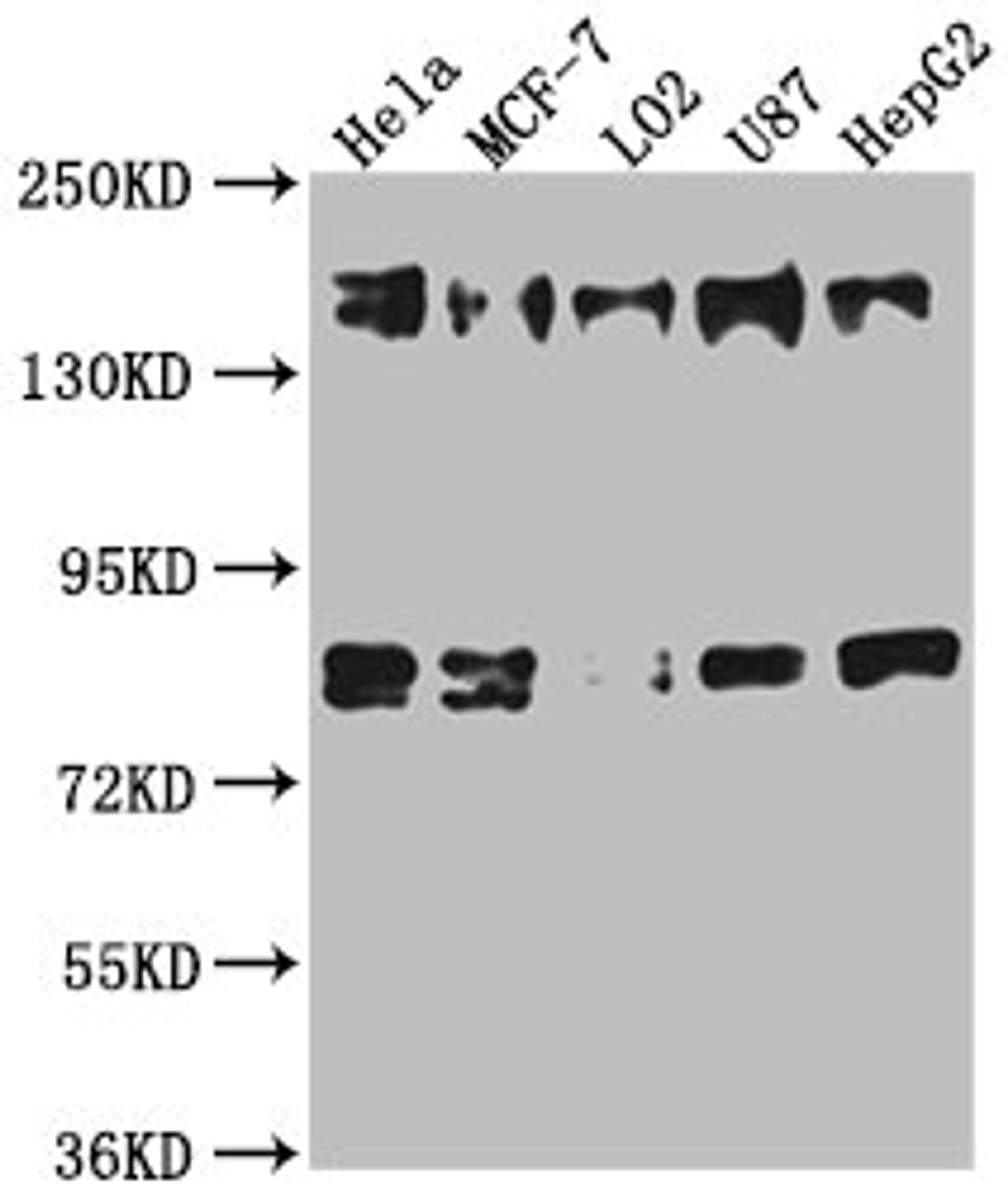 Western Blot. Positive WB detected in: Hela whole cell lysate, MCF-7 whole cell lysate, L02 whole cell lysate, U87 whole cell lysate, HepG2 whole cell lysate. All lanes: ZFYVE9 antibody at 1:1000. Secondary. Goat polyclonal to rabbit IgG at 1/50000 dilution. Predicted band size: 157, 151, 84 kDa. Observed band size: 157 kDa.