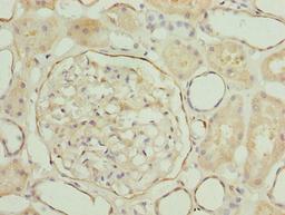 Immunohistochemistry of paraffin-embedded human kidney tissue using CSB-PA013183LA01HU at dilution of 1:100