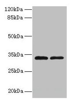 Western blot. All lanes: TMEM71 antibody at 0.2µg/ml. Lane 1: U937 whole cell lysate. Lane 2: U87 whole cell lysate. Secondary. Goat polyclonal to rabbit IgG at 1/10000 dilution. Predicted band size: 33, 31, 27 kDa. Observed band size: 33 kDa