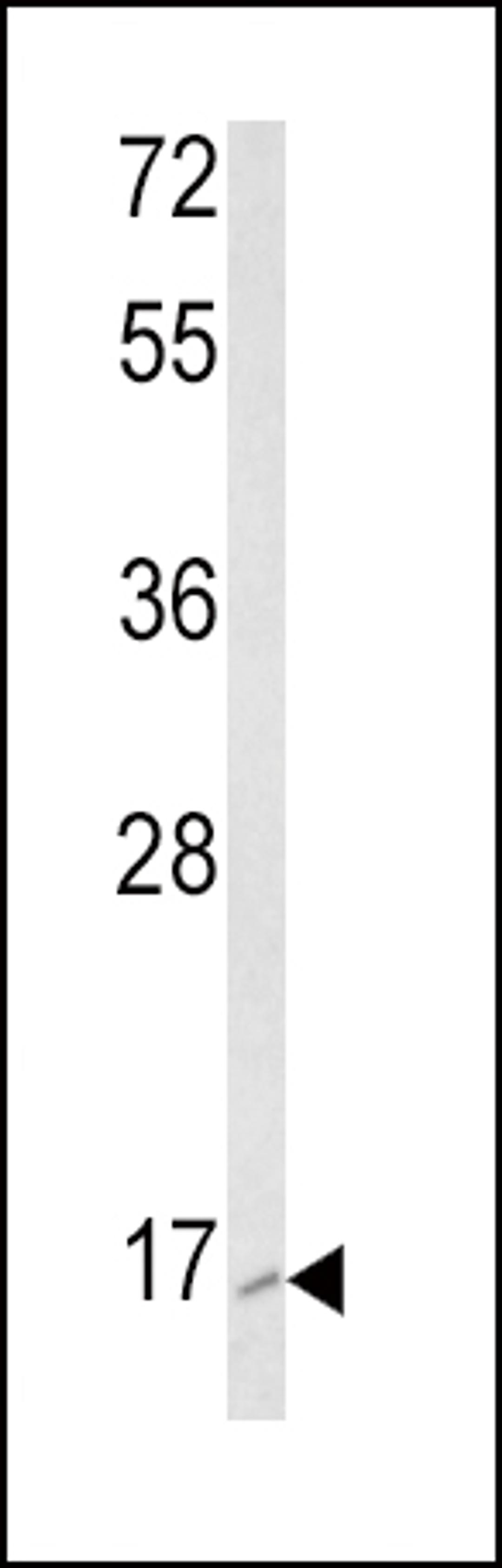 Western blot analysis of RAC2 Antibody in K562 cell line lysates (35ug/lane)