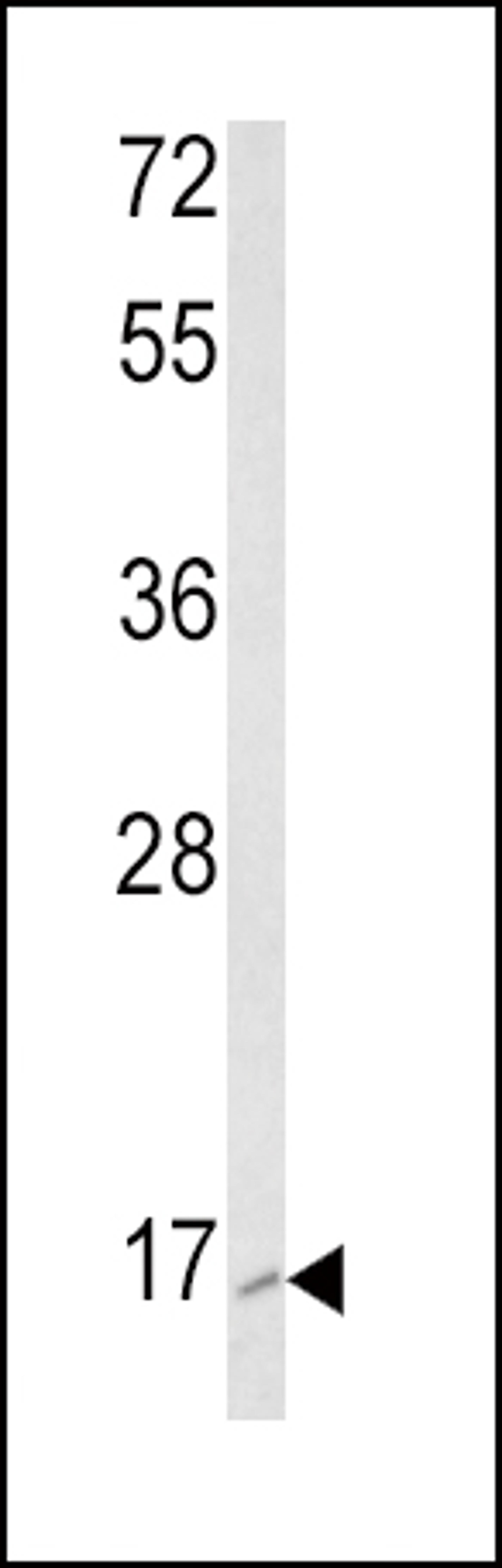 Western blot analysis of RAC2 Antibody in K562 cell line lysates (35ug/lane)