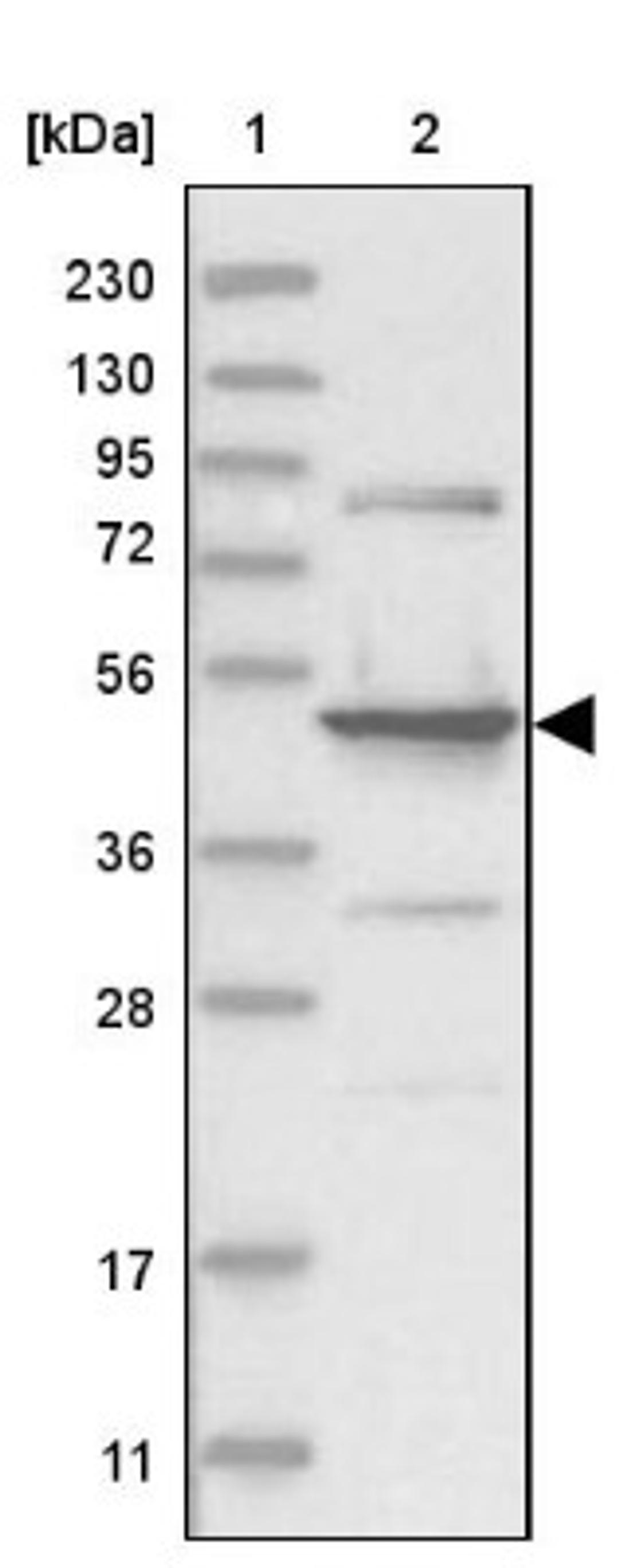 Western Blot: HMGCS2 Antibody [NBP2-33907] - Lane 1: Marker [kDa] 230, 130, 95, 72, 56, 36, 28, 17, 11<br/>Lane 2: Human cell line RT-4