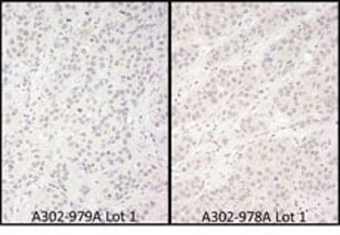 Detection of human DDX56 by immunohistochemistry.