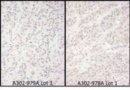 Detection of human DDX56 by immunohistochemistry.