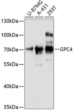 Western blot - GPC4 antibody (A12805)