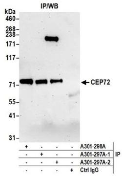 Detection of human CEP72 by western blot of immunoprecipitates.