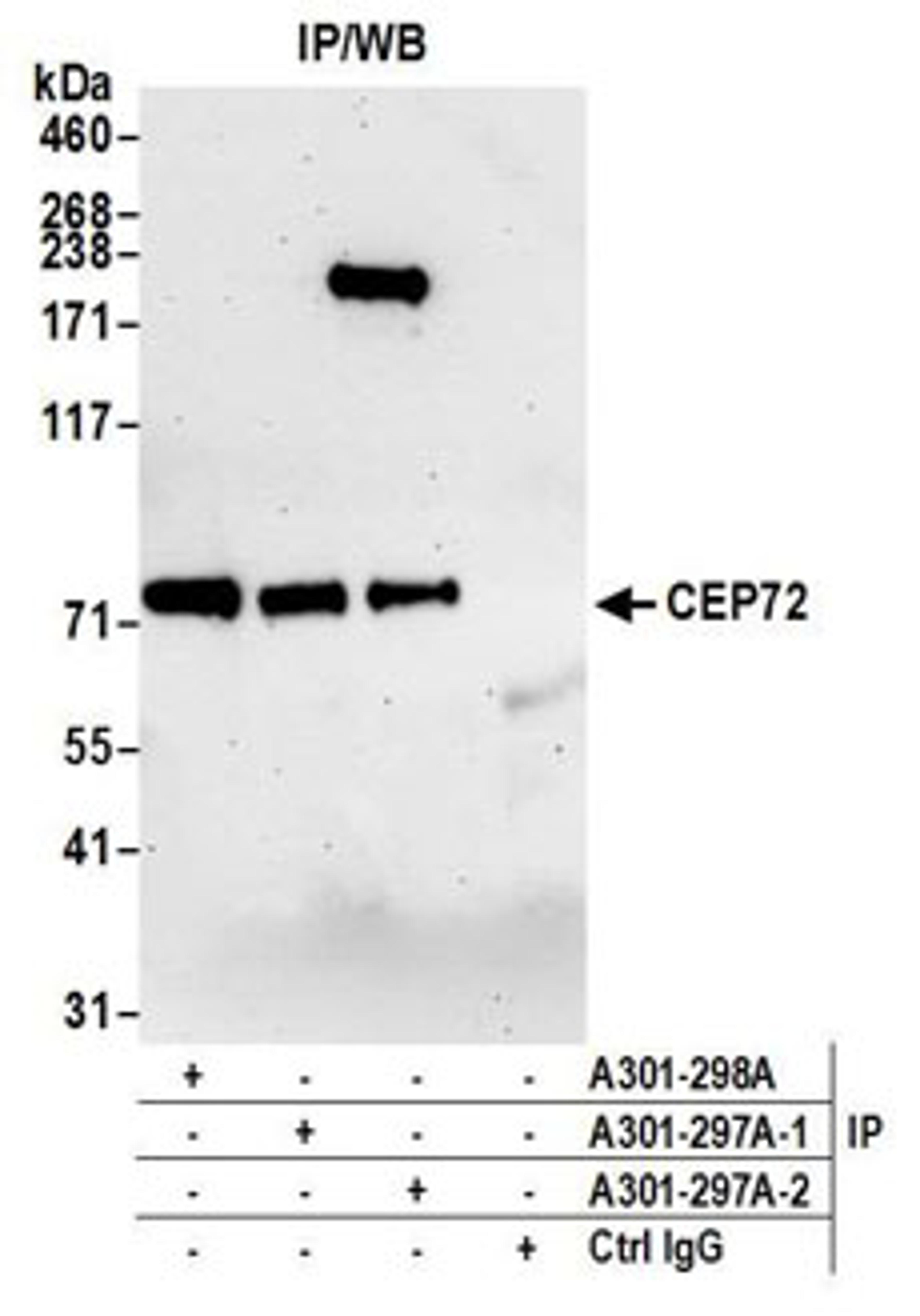 Detection of human CEP72 by western blot of immunoprecipitates.