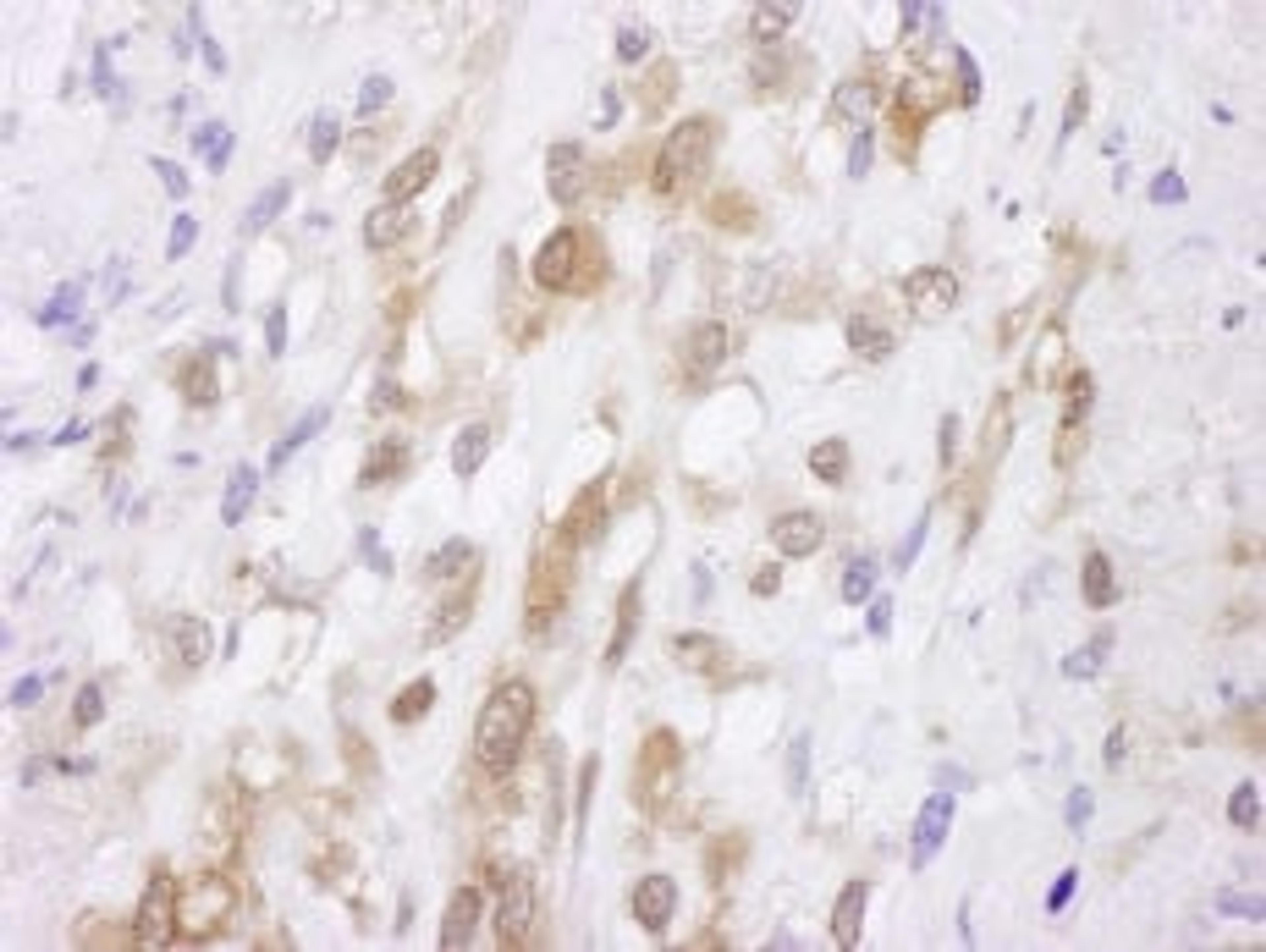 Detection of human SOD1 by immunohistochemistry.