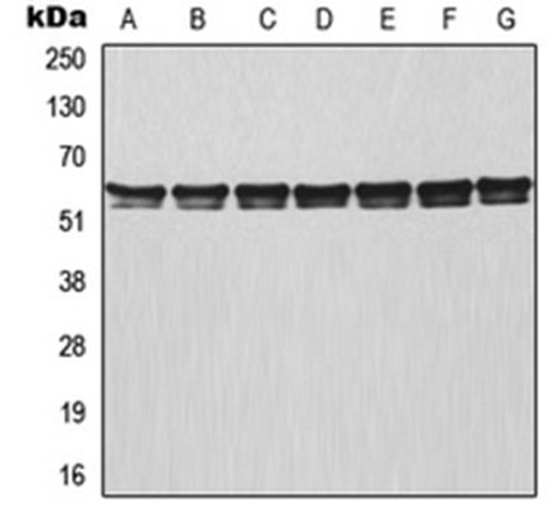 Western blot analysis of MCF7 (Lane 1), HeLa (Lane 2), Raji (Lane 3), NIH3T3 (Lane 4), mouse lung (Lane 5), rat colon (Lane 6), PC12 (Lane 7) whole cell lysates using TRAF3 antibody