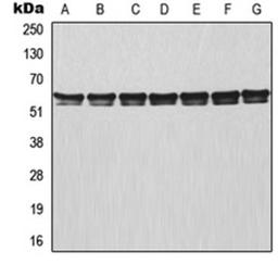 Western blot analysis of MCF7 (Lane 1), HeLa (Lane 2), Raji (Lane 3), NIH3T3 (Lane 4), mouse lung (Lane 5), rat colon (Lane 6), PC12 (Lane 7) whole cell lysates using TRAF3 antibody