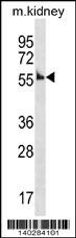 Western blot analysis in mouse kidney tissue lysates (35ug/lane).