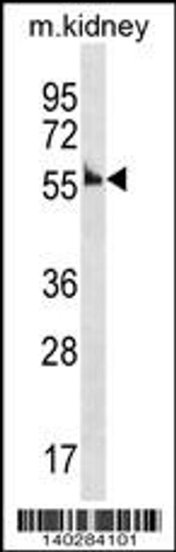 Western blot analysis in mouse kidney tissue lysates (35ug/lane).