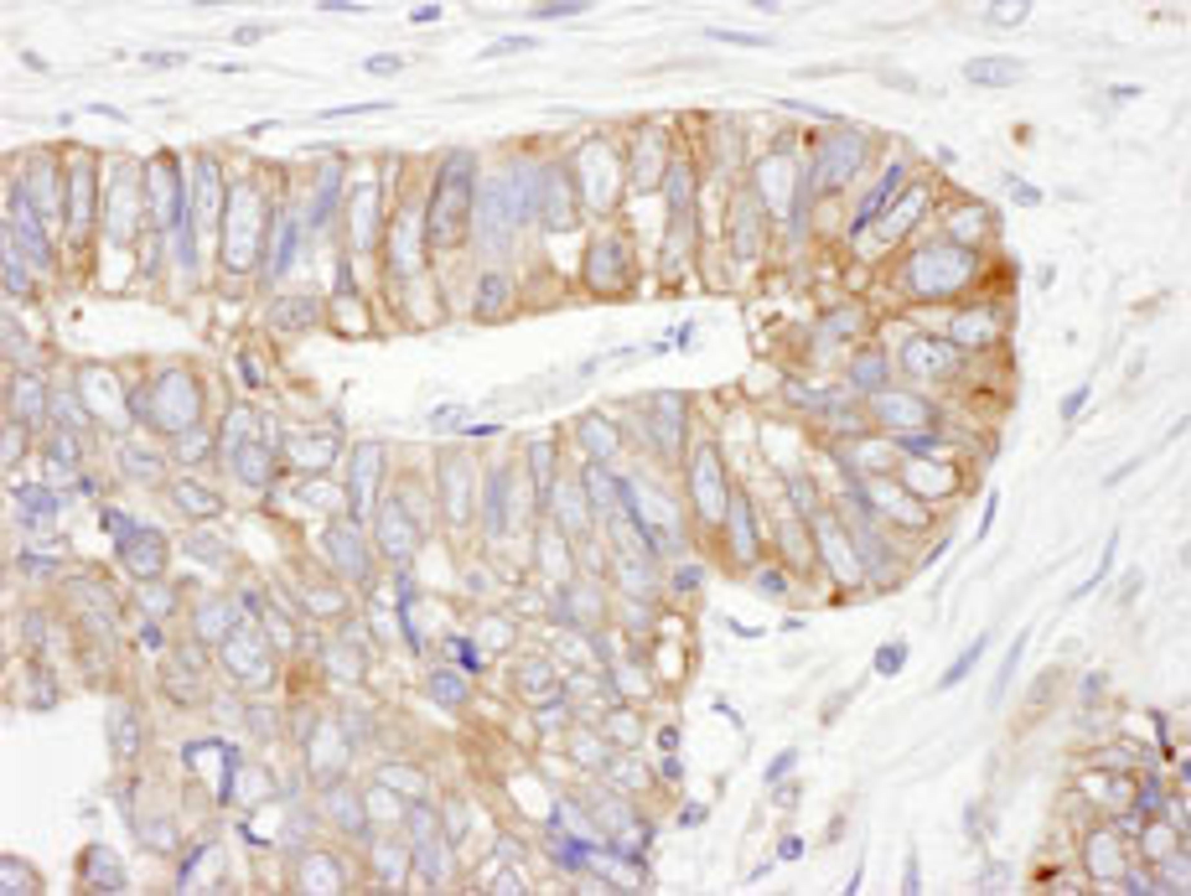 Detection of human ERp5 by immunohistochemistry.