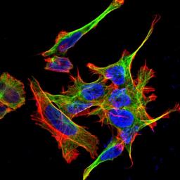 Immunofluorescence analysis of neuroblastoma cell line sk-n-be using GABARAPL1 antibody