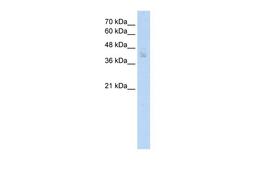 Antibody used in WB on Human MCF7 cells at 2.5 ug/ml.