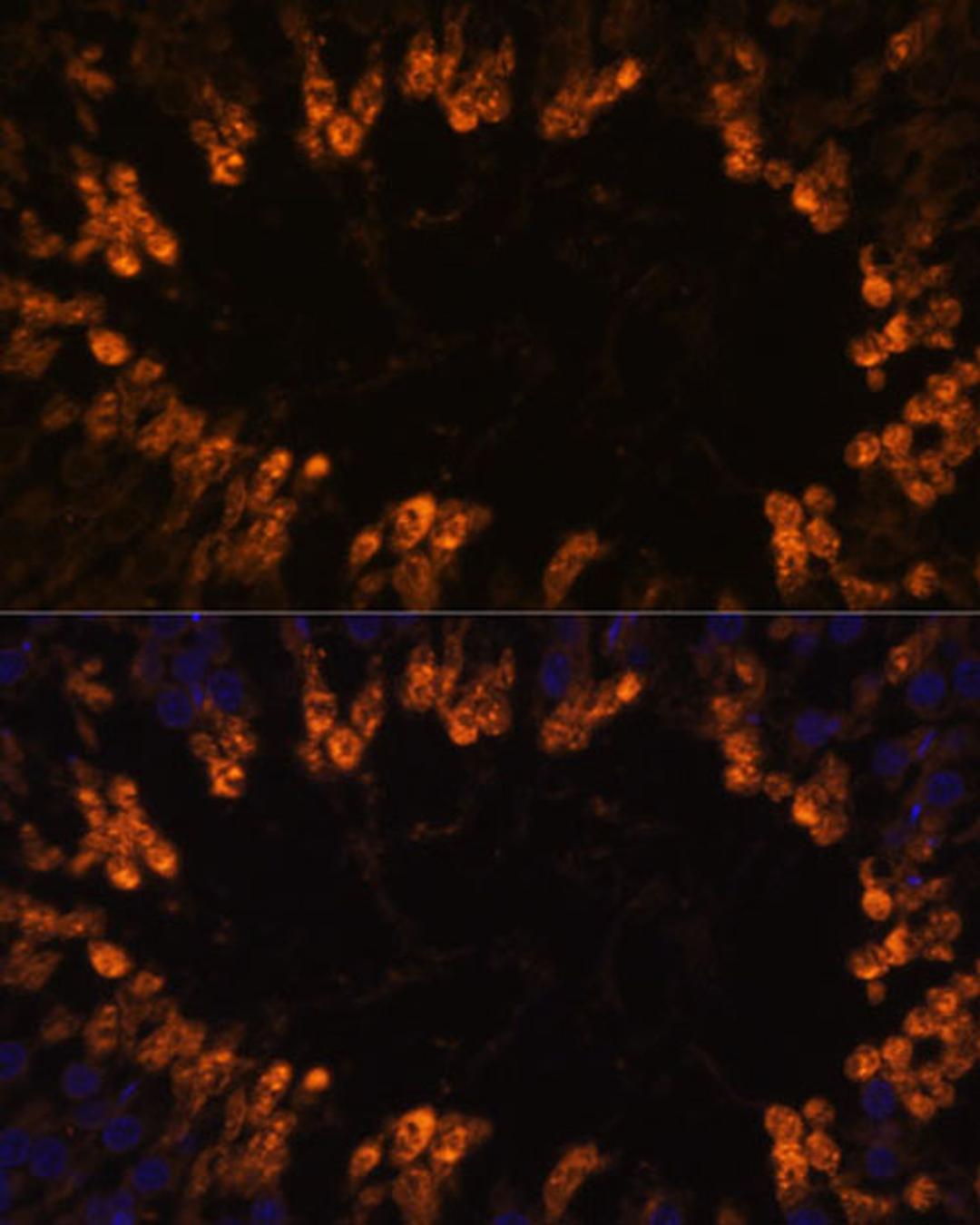 Immunofluorescence - OXCT2 antibody (A14920)