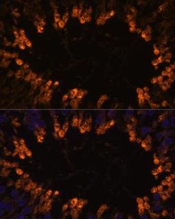 Immunofluorescence - OXCT2 antibody (A14920)