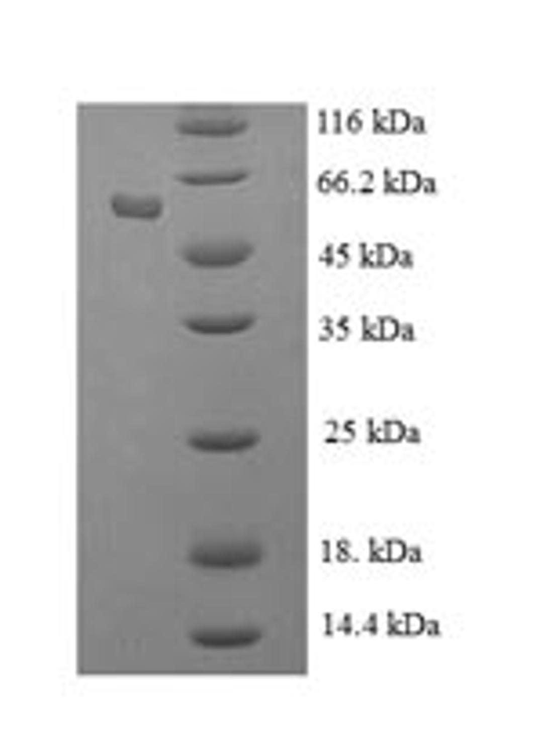 (Tris-Glycine gel) Discontinuous SDS-PAGE (reduced) with 5% enrichment gel and 15% separation gel.