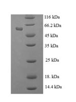 (Tris-Glycine gel) Discontinuous SDS-PAGE (reduced) with 5% enrichment gel and 15% separation gel.