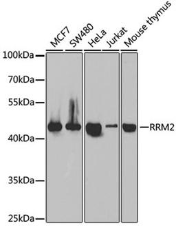 Western blot - RRM2 antibody (A5255)