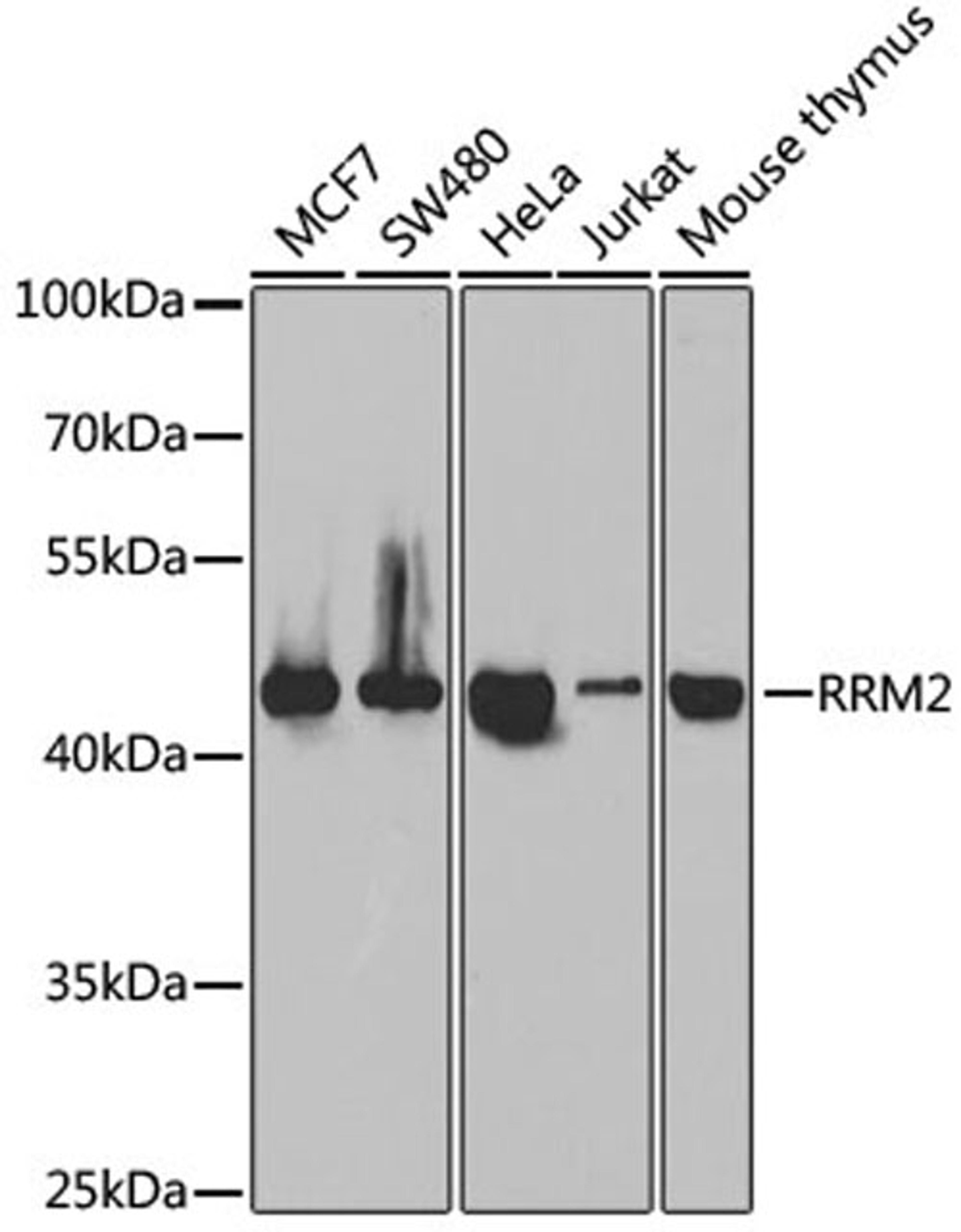 Western blot - RRM2 antibody (A5255)