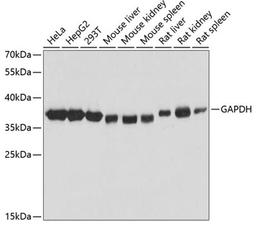 Western blot - GAPDH antibody (AC027)