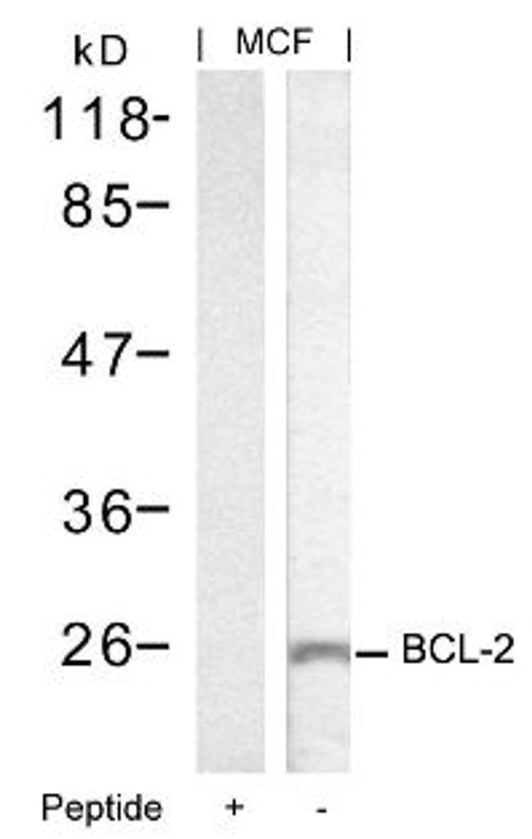 Western blot analysis of lysed extracts from MCF cells using BCL-2 (Ab-70).