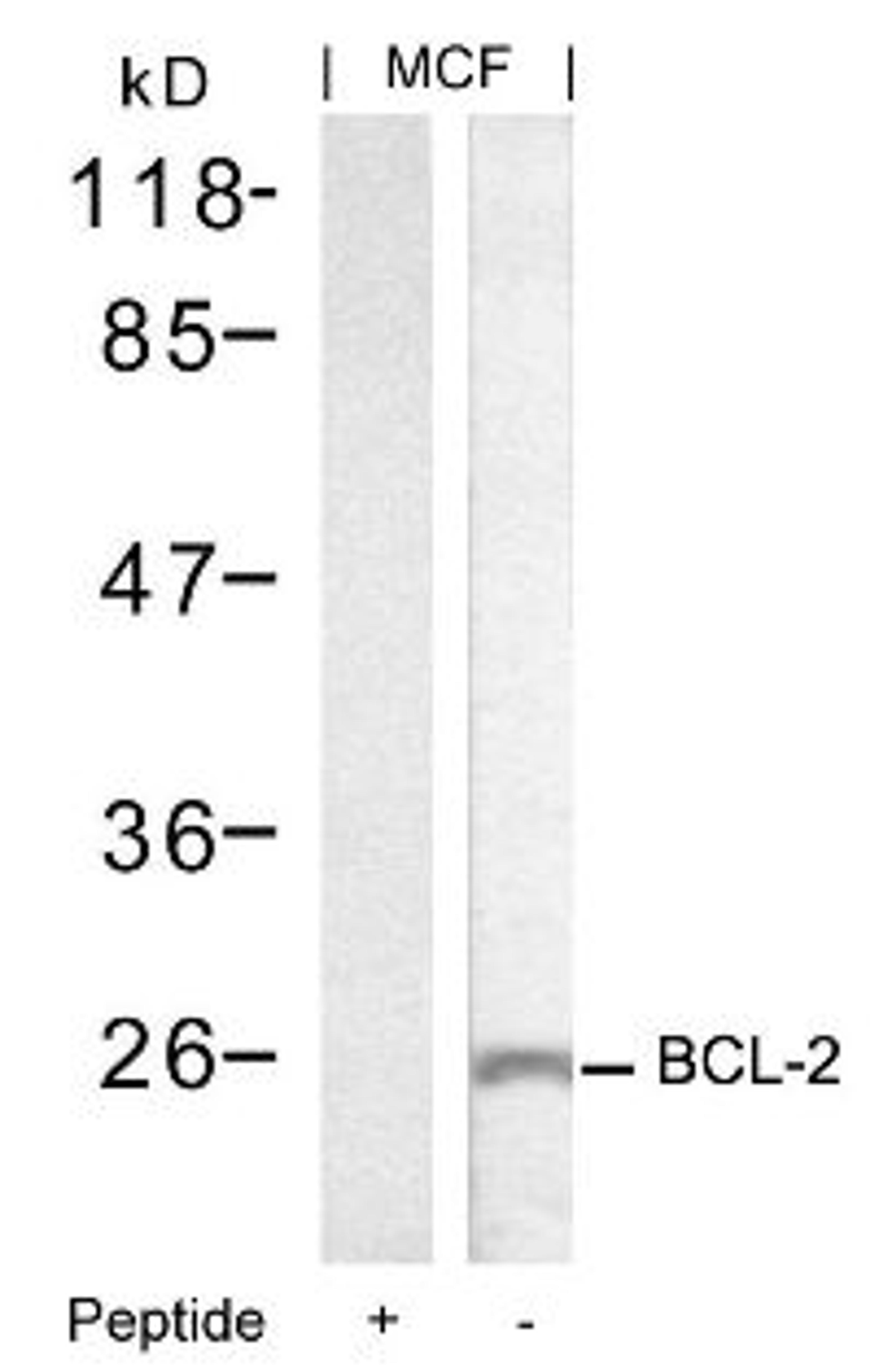 Western blot analysis of lysed extracts from MCF cells using BCL-2 (Ab-70).