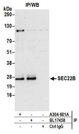 Detection of human SEC22B by western blot of immunoprecipitates.