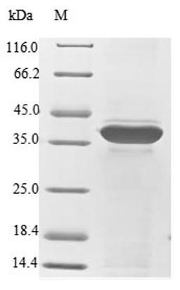 (Tris-Glycine gel) Discontinuous SDS-PAGE (reduced) with 5% enrichment gel and 15% separation gel.