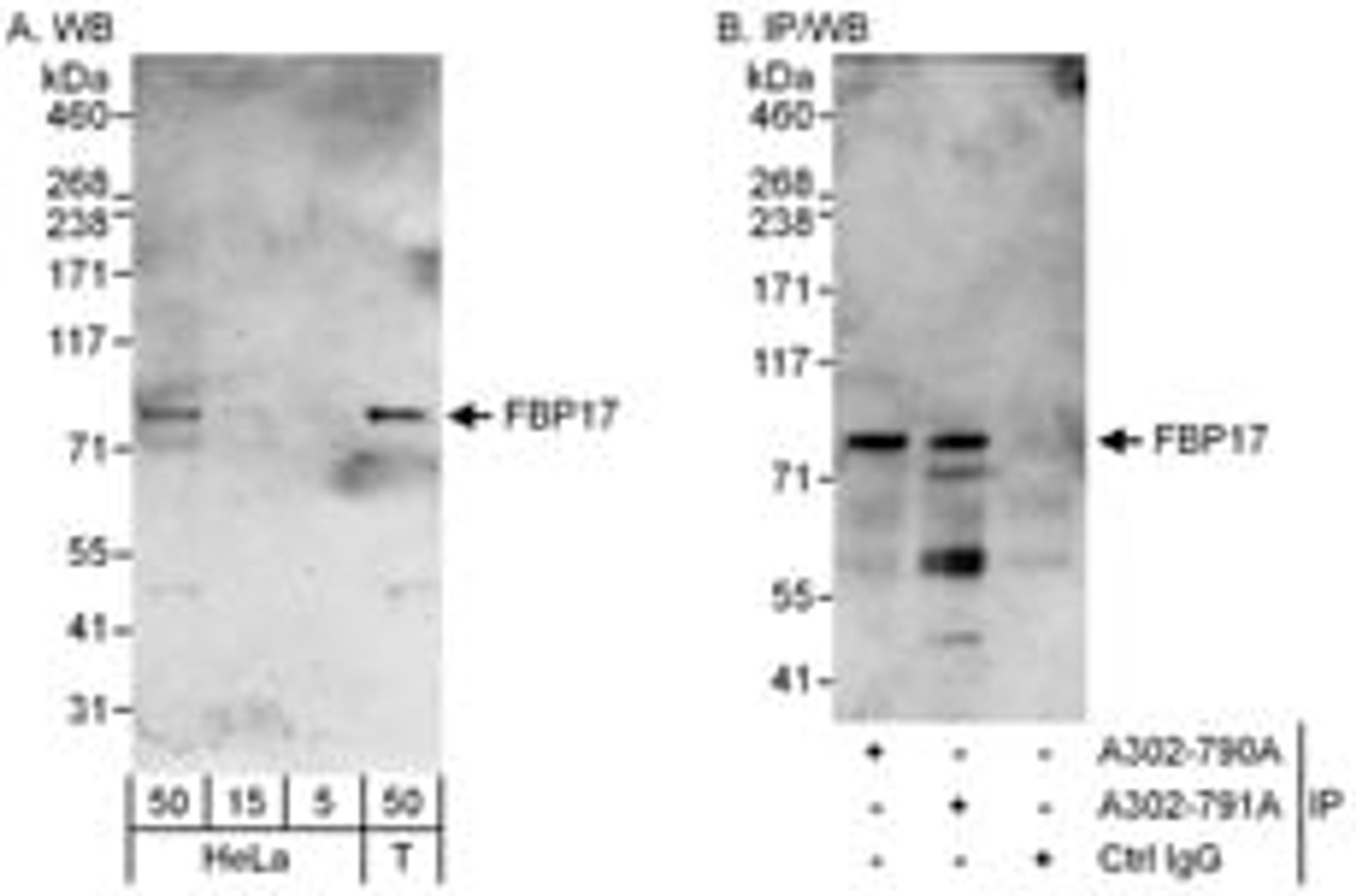 Detection of human FBP17 by western blot and immunoprecipitation.