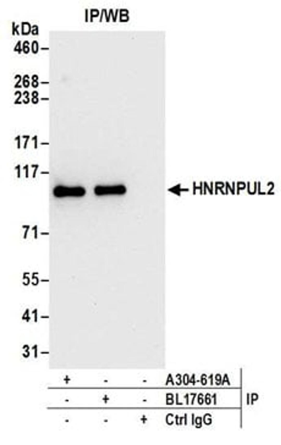 Detection of human HNRNPUL2 by western blot of immunoprecipitates.