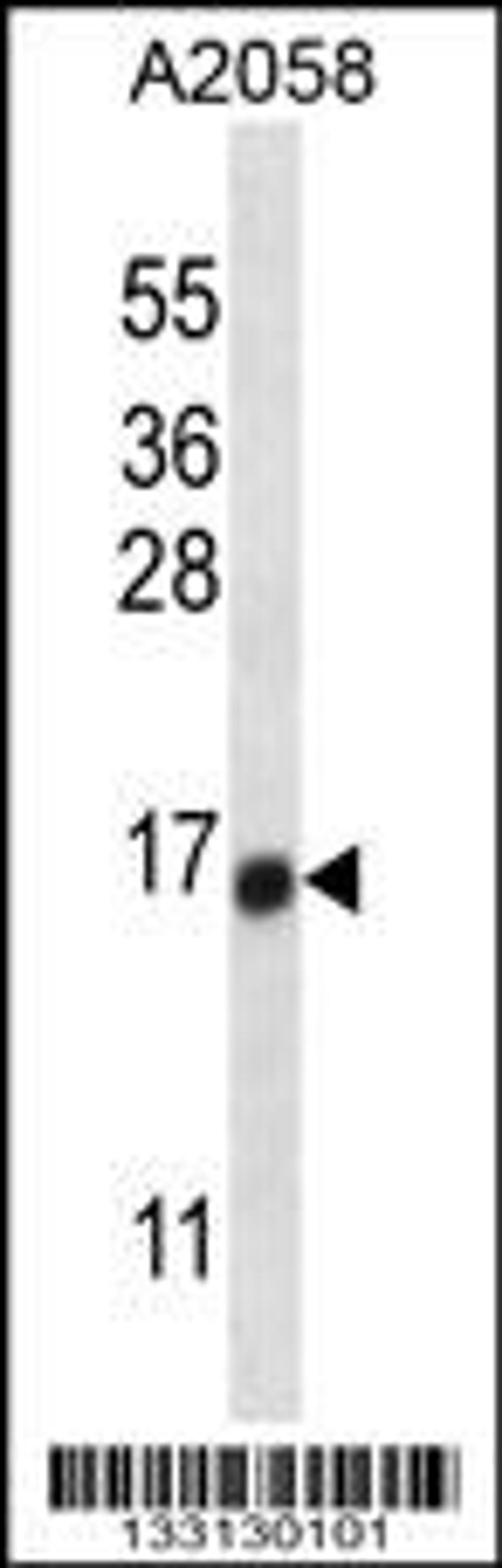 Western blot analysis in A2058 cell line lysates (35ug/lane).