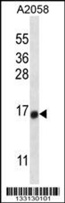 Western blot analysis in A2058 cell line lysates (35ug/lane).