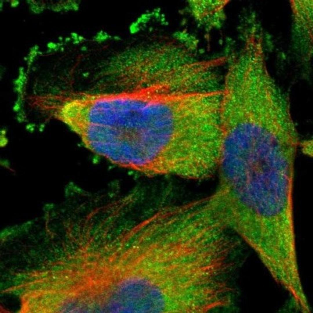 Immunocytochemistry/Immunofluorescence: ARID5B Antibody [NBP1-83622] - Staining of human cell line U-251MG shows positivity in plasma membrane & cytoplasm. Dilution: 1-4 ug/ml