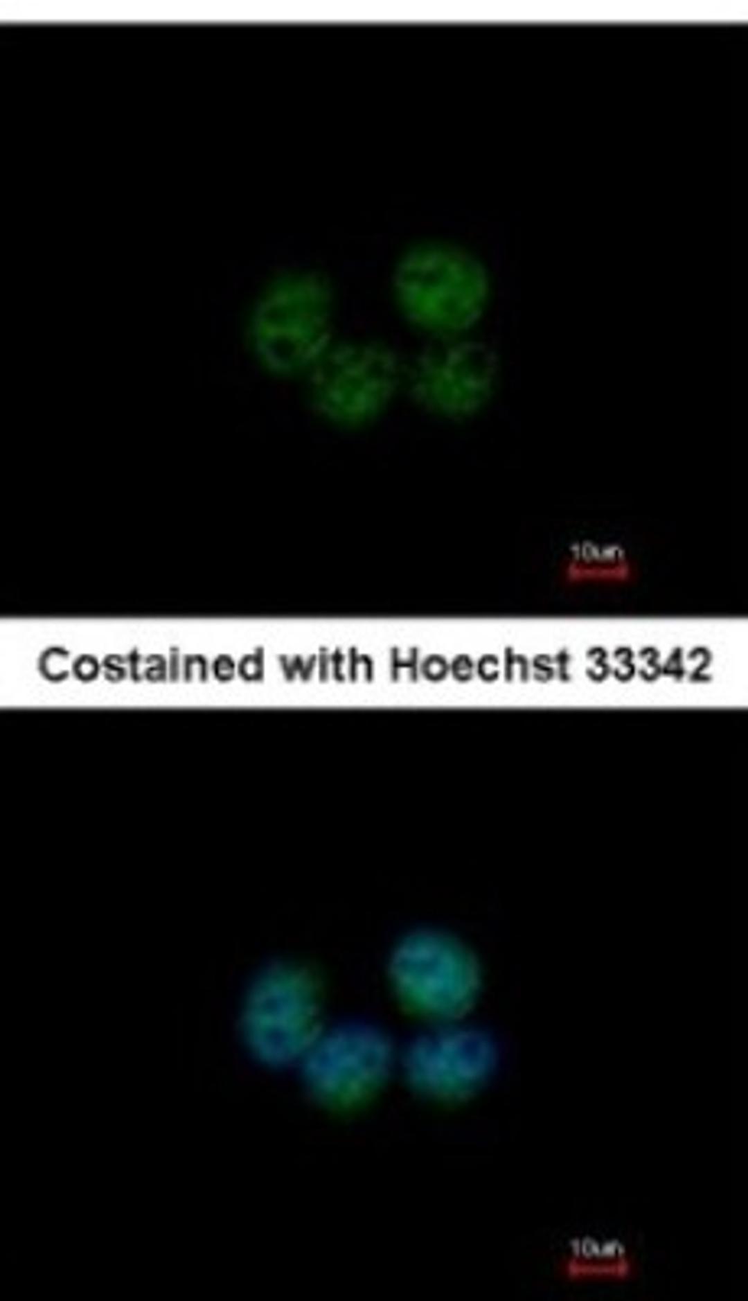 Immunocytochemistry/Immunofluorescence: SOHLH2 Antibody [NBP2-20453] - Analysis of paraformaldehyde-fixed MCF-7, using antibody at 1:200 dilution.