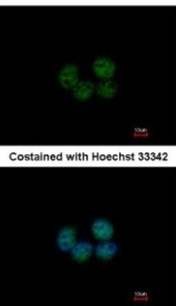 Immunocytochemistry/Immunofluorescence: SOHLH2 Antibody [NBP2-20453] - Analysis of paraformaldehyde-fixed MCF-7, using antibody at 1:200 dilution.