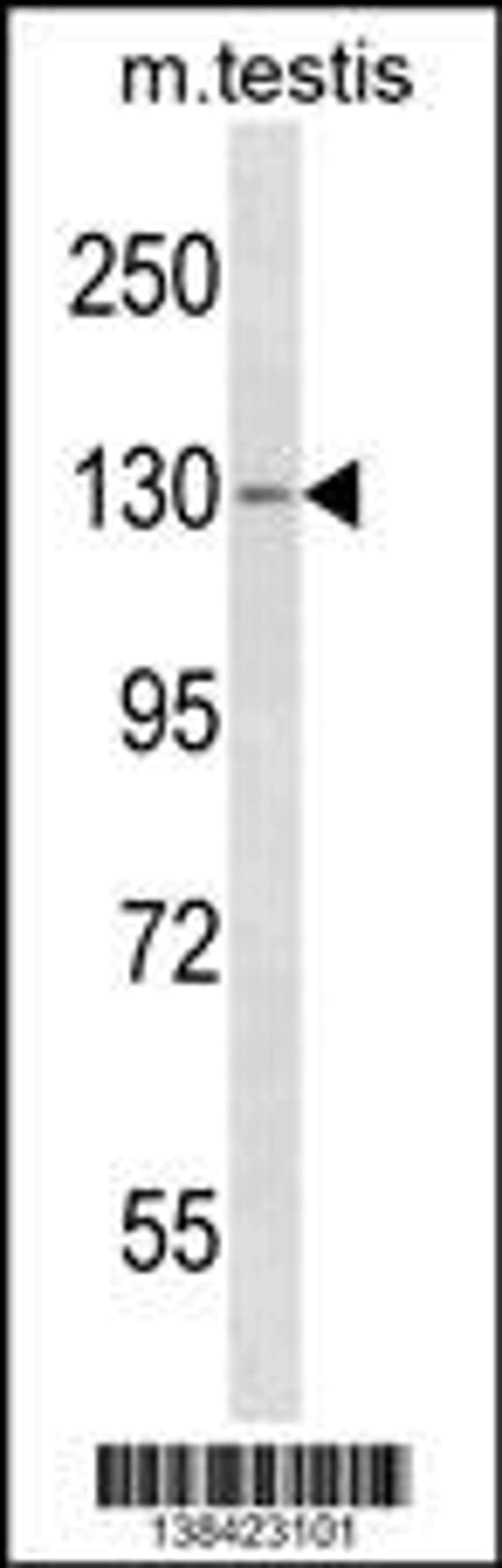 Western blot analysis in mouse testis tissue lysates (35ug/lane).