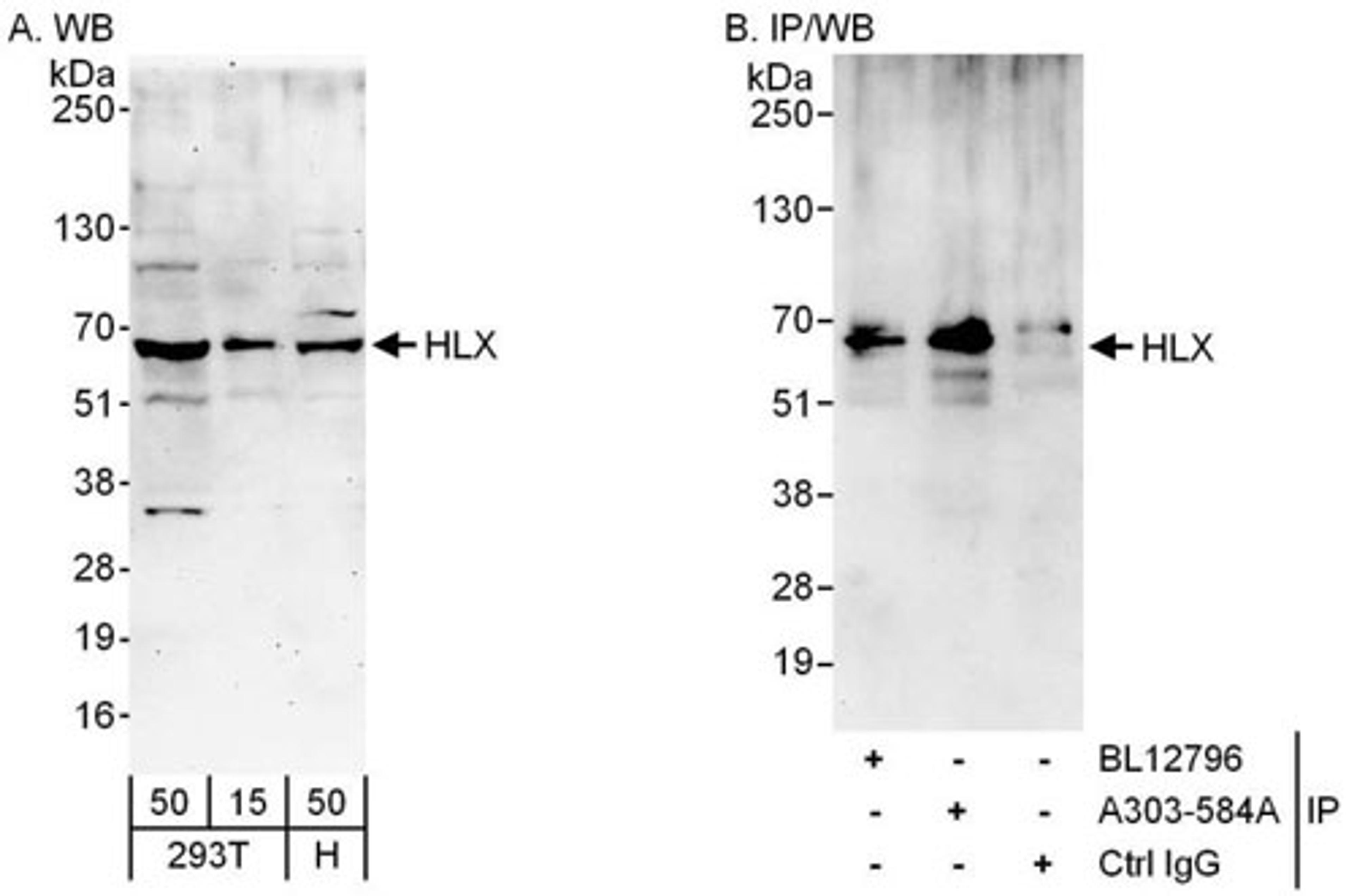 Detection of human HLX by WB and IP.