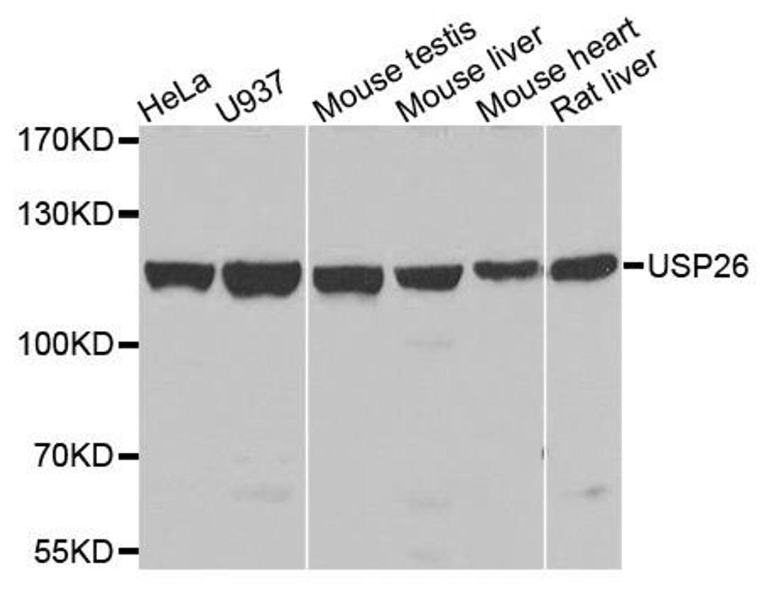 Western blot analysis of extracts of various cells using USP26 antibody