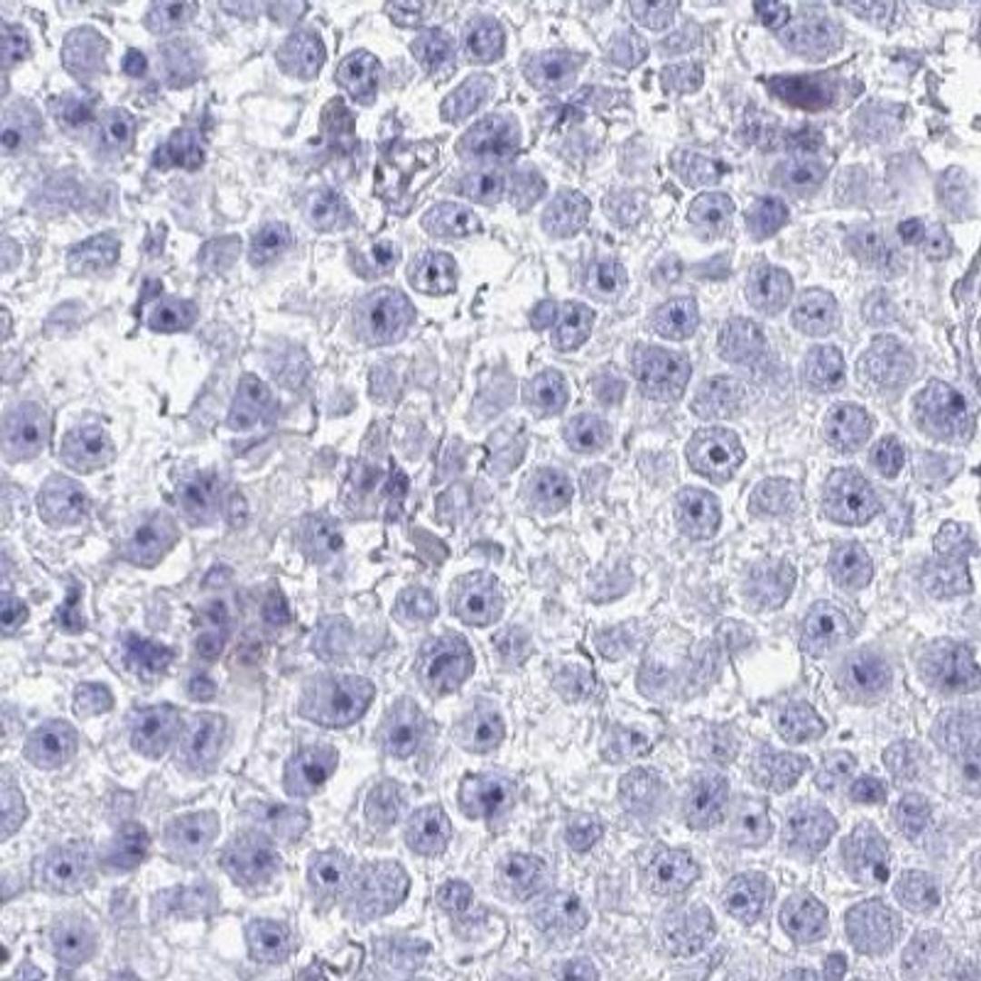 Immunohistochemistry: DPEP3 Antibody [NBP2-32395] - testis cancer