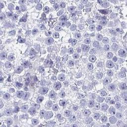 Immunohistochemistry: DPEP3 Antibody [NBP2-32395] - testis cancer