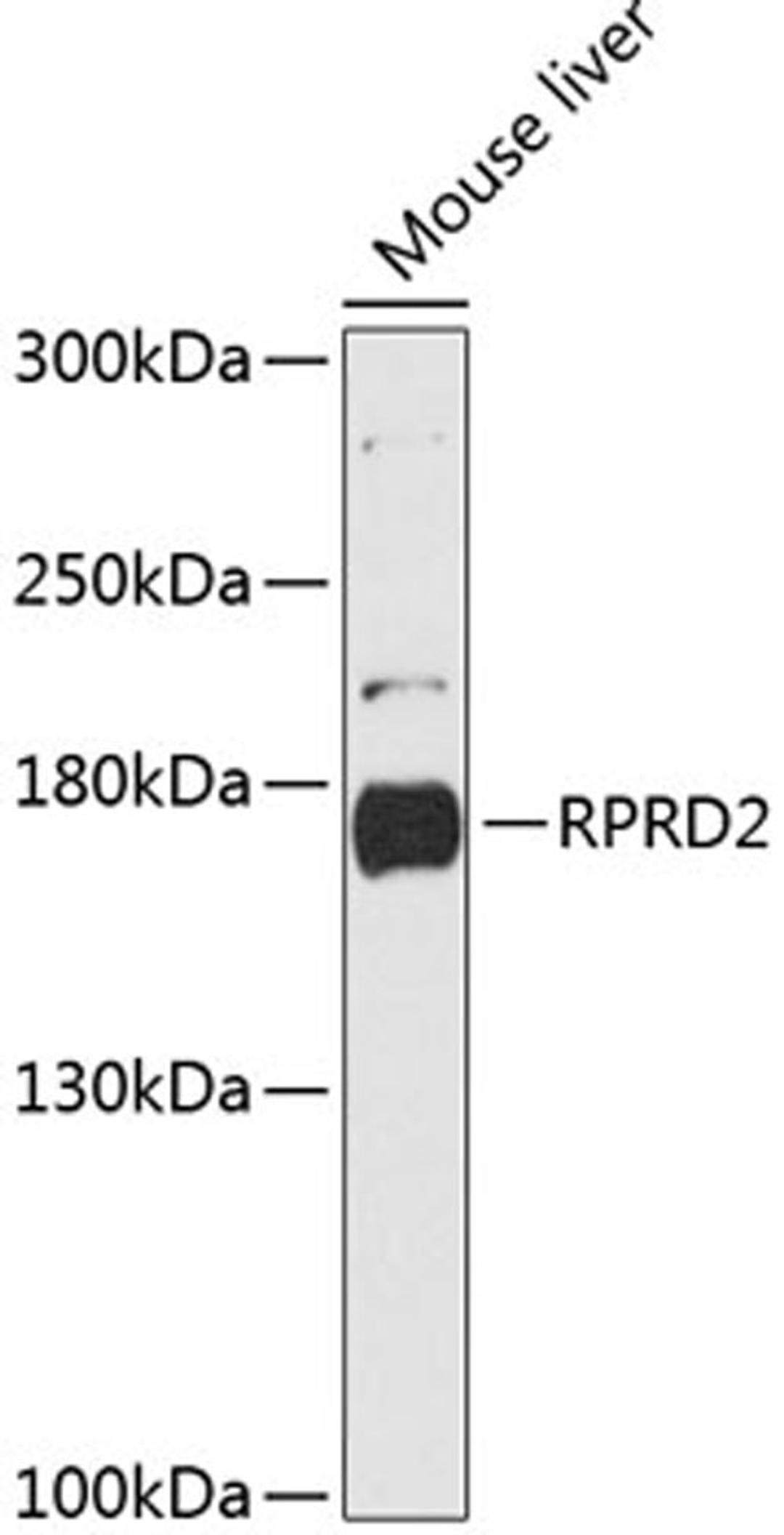 Western blot - RPRD2 antibody (A13079)