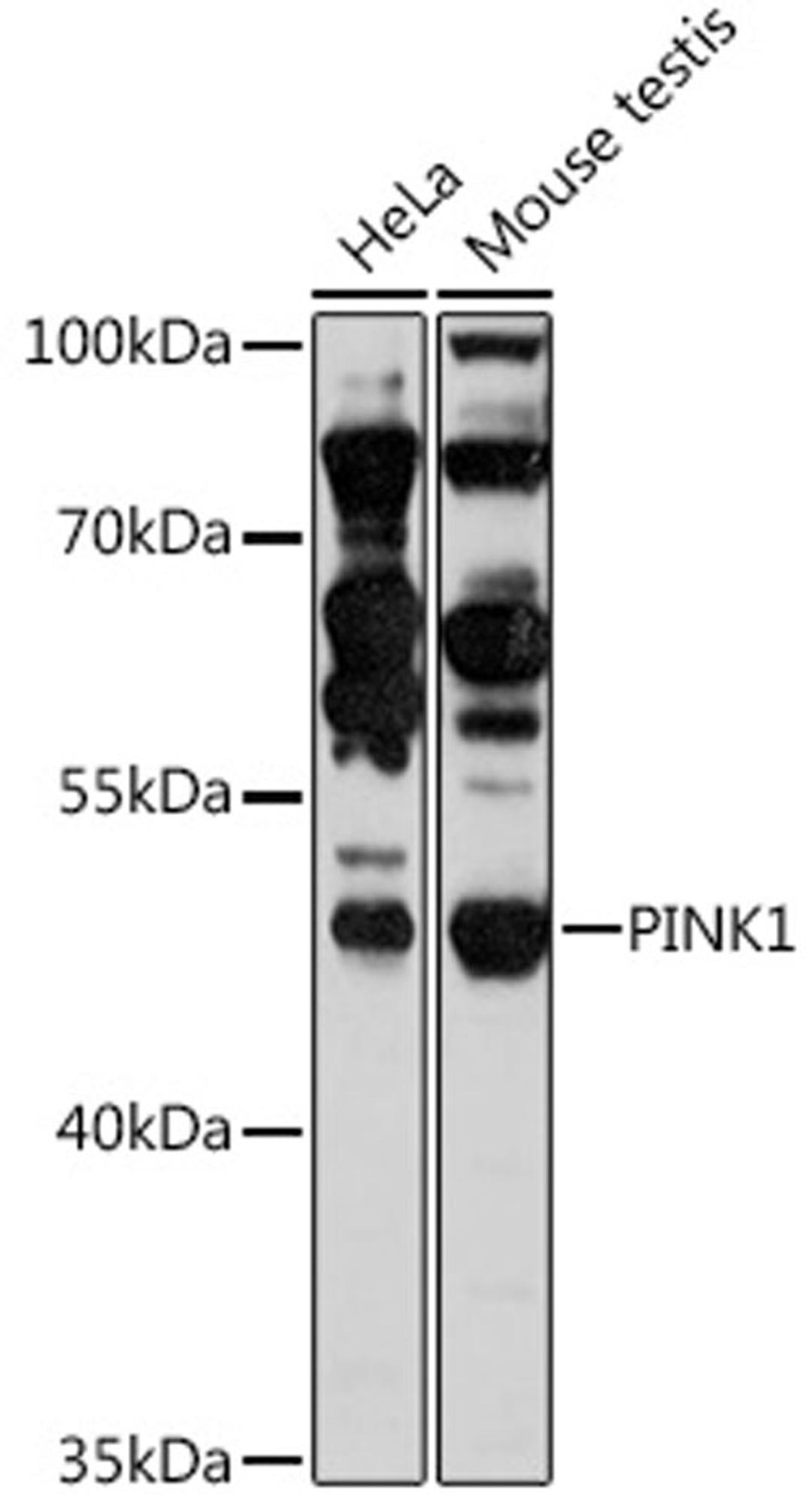 Western blot - PINK1 antibody (A11435)