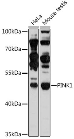 Western blot - PINK1 antibody (A11435)